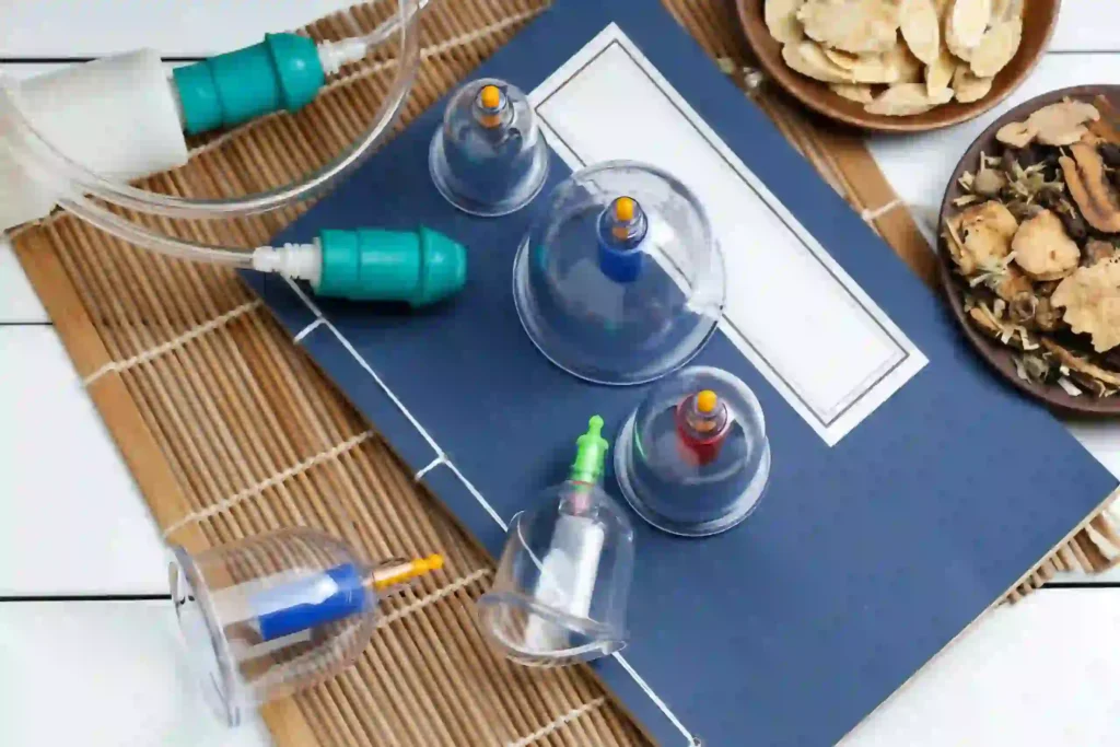 Hijama cupping therapy equipment used for pain relief and detox treatment in Kuwait